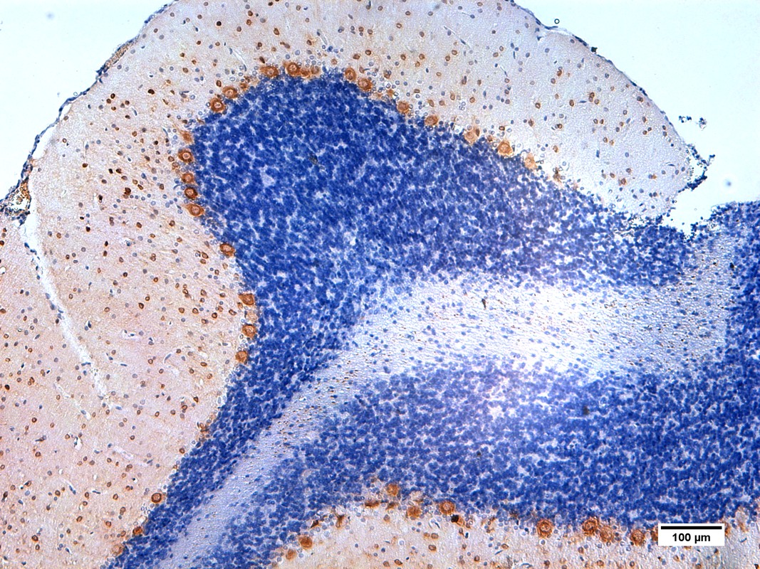 Figure 5. Parvalbumin positive neurons visualized in rat cerebellum using DAB staining using hematoxylin counterstain