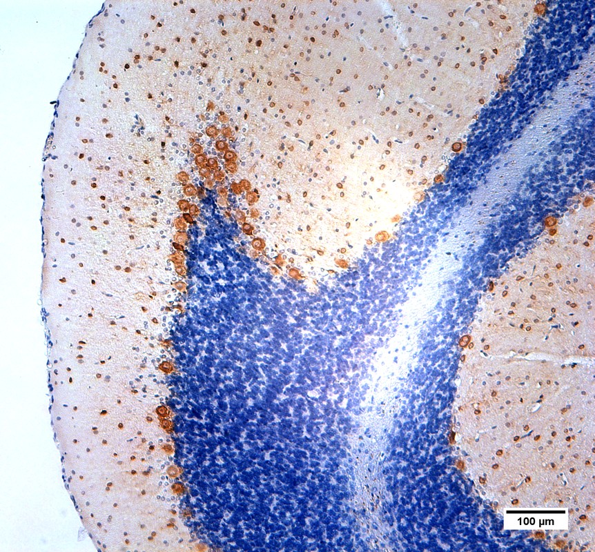 Figure 1. Parvalbumin positive neurons visualized in rat cerebellum using DAB staining