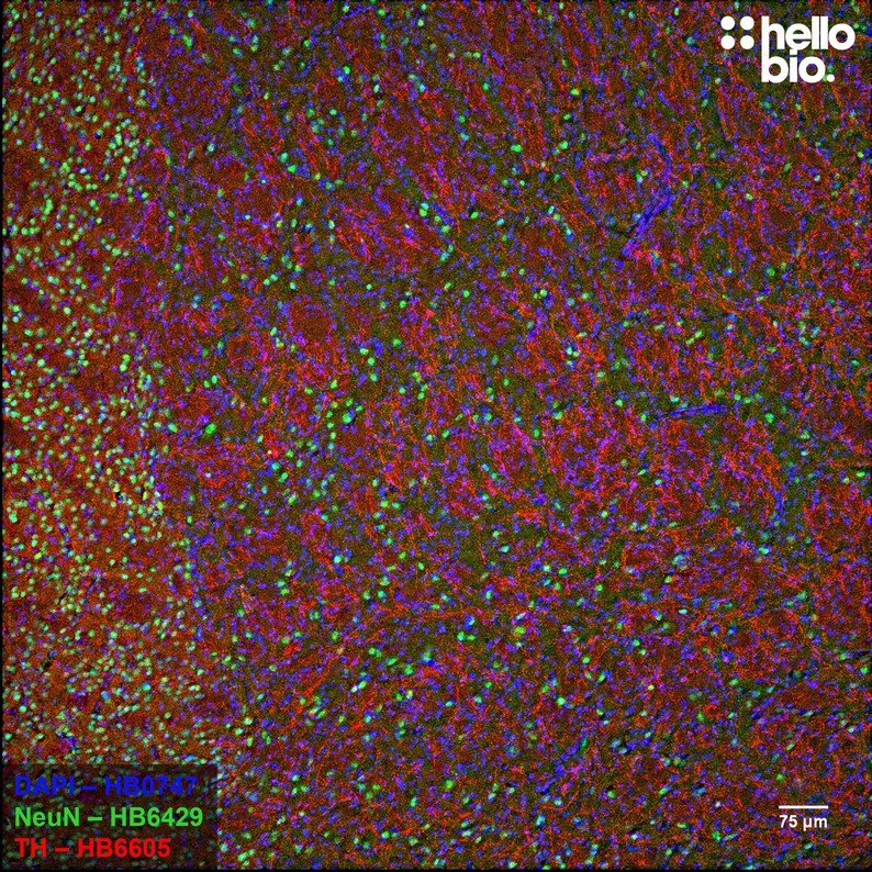 Figure 2. NeuN and Tyrosine hydroxylase expression in rat striatum. Figure 2. NeuN and Tyrosine hydroxylase expression in rat striatum.