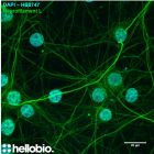 DAPI (HB0747) and NFL expression in cultured neurones.