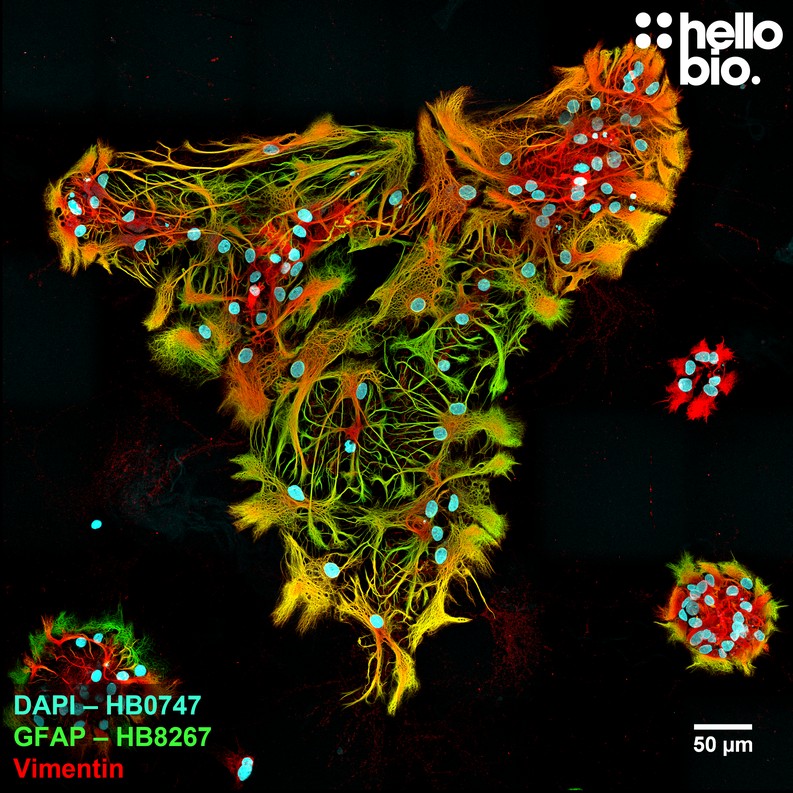 Figure 2. GFAP and Vimentin expression in a rat cultured neuron preparation visualised using HB8267 and an anti-Vimentin antibody. 