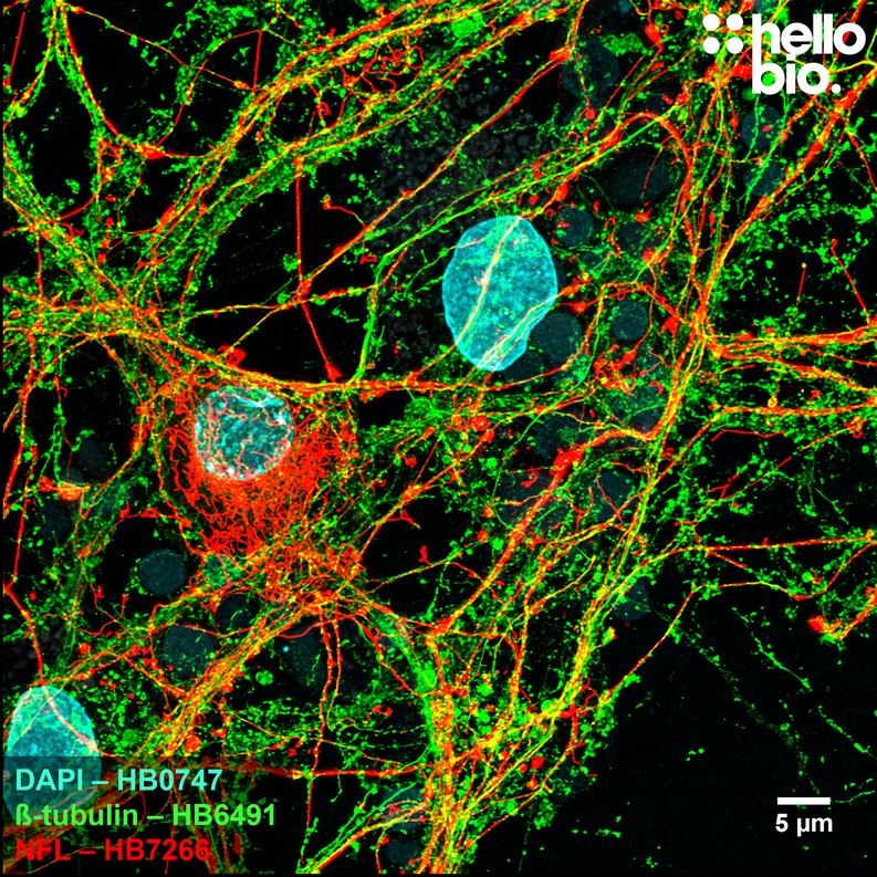 Figure 4. ß-Tubulin and Neurofilament L expression in cultured rat neurones.