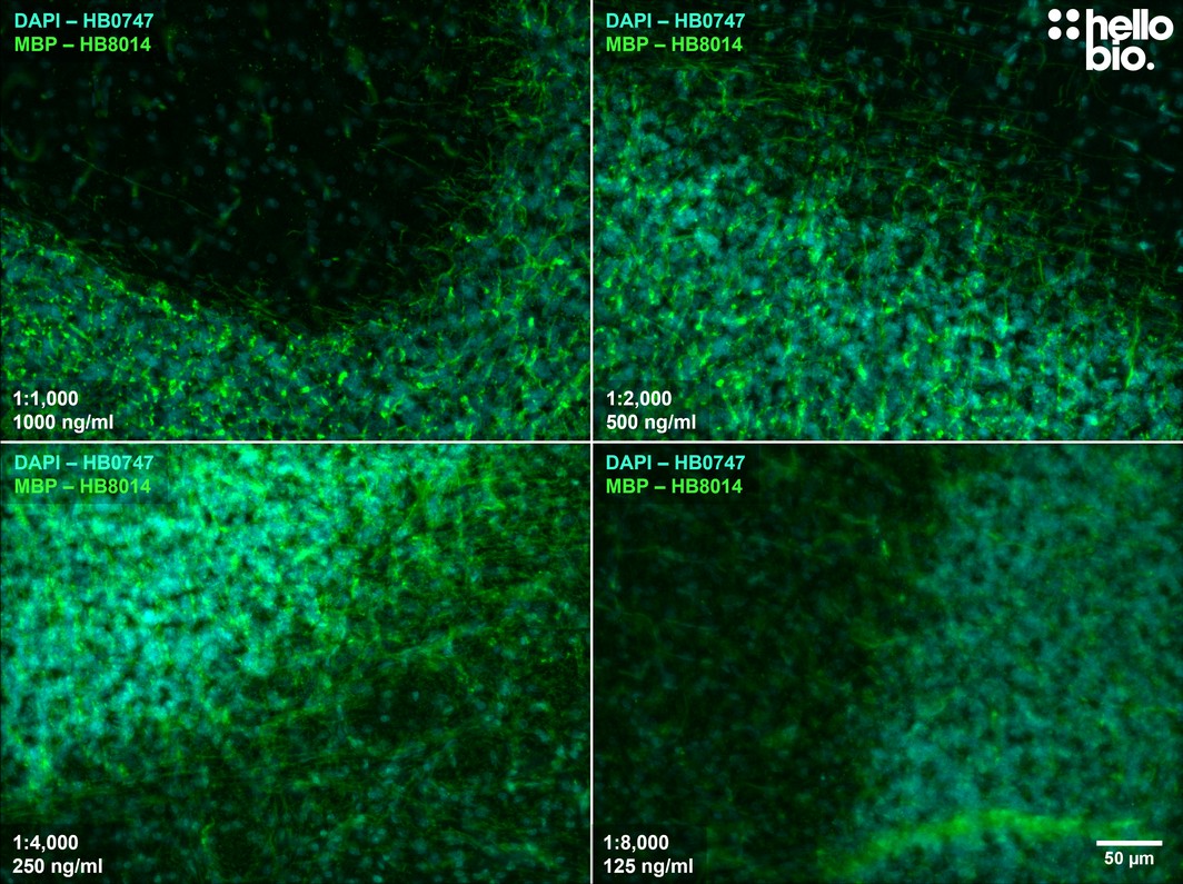 Figure 5. The effect of varying HB8014 concentration upon MBP staining in rat cerebellum. 