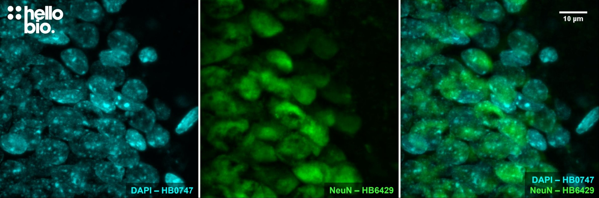 Figure 10. NeuN expression in the granule cell layer of the rat dentate gyrus visualised using HB6429. Figure 10. NeuN expression in the granule cell layer of the rat dentate gyrus visualised using HB6429.