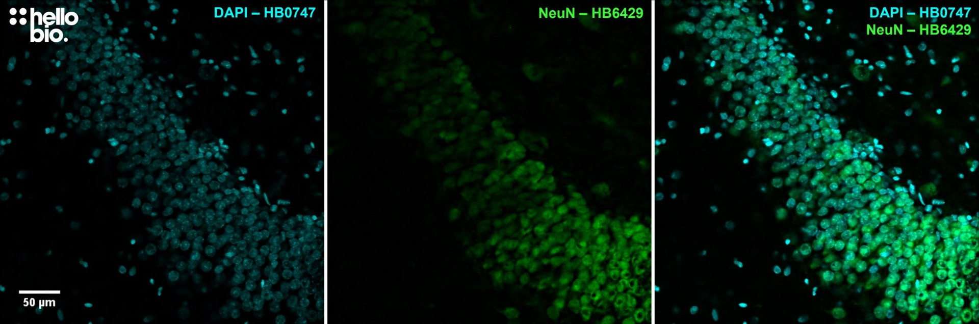Figure 5. NeuN expression in the granule cell layer of the rat dentate gyrus visualised using HB6429. Figure 5. NeuN expression in the granule cell layer of the rat dentate gyrus visualised using HB6429.