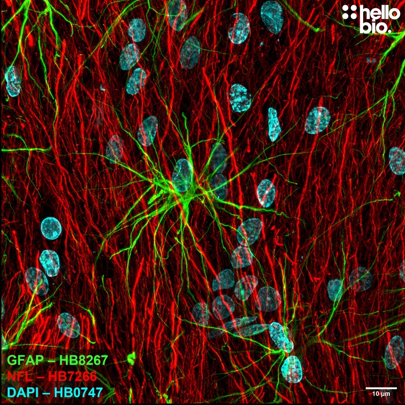 Figure 3. GFAP labelled astrocyte in rat brain. 
