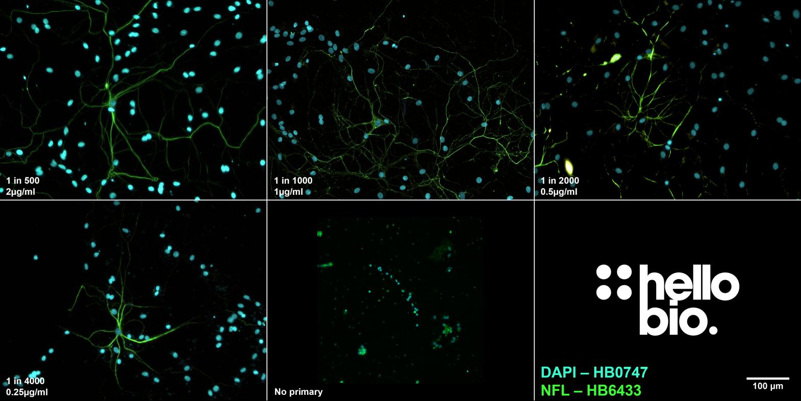 Figure 3. The effect of varying HB6433 concentration upon staining in cultured rat neurones. 