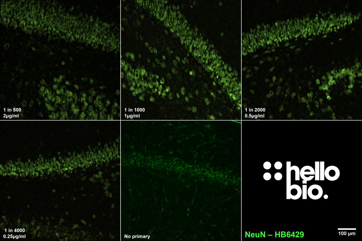 Figure 6. The effect of varying HB6429 concentration upon staining in rat dentate gyrus Figure 6. The effect of varying HB6429 concentration upon staining in rat dentate gyrus