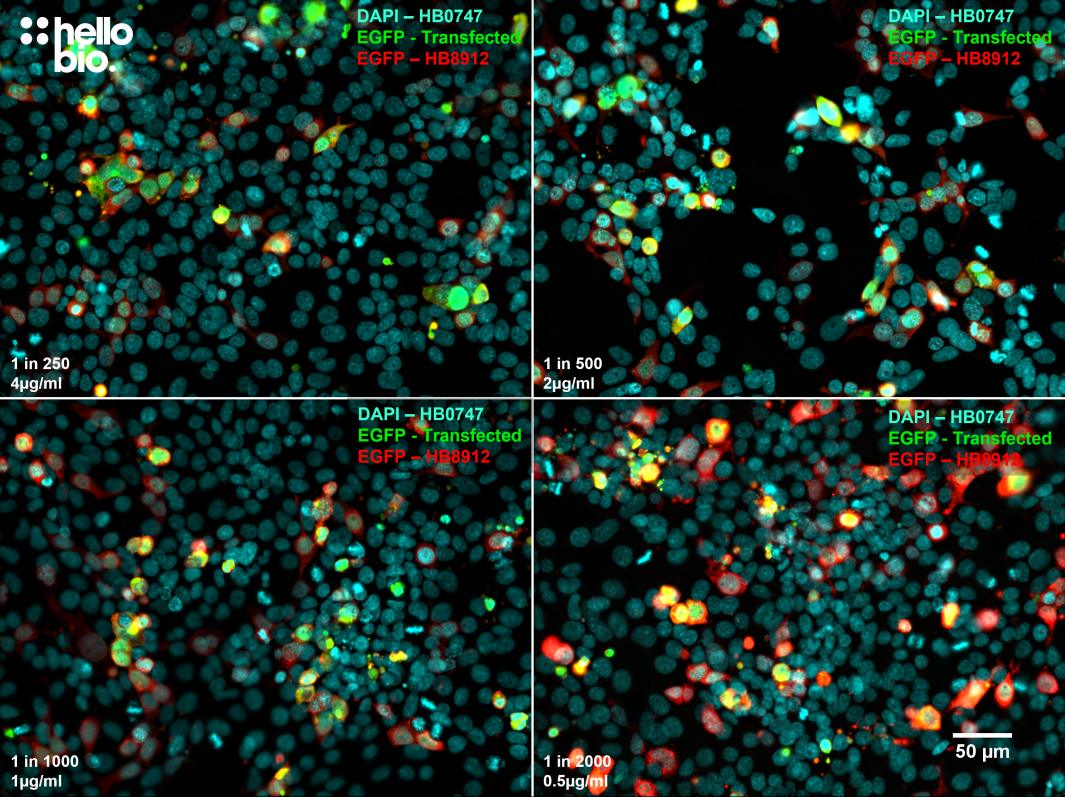 Figure 4. The effect of varying HB8912 concentration upon staining in pEGFP-C2 transfected HEK293 cells.