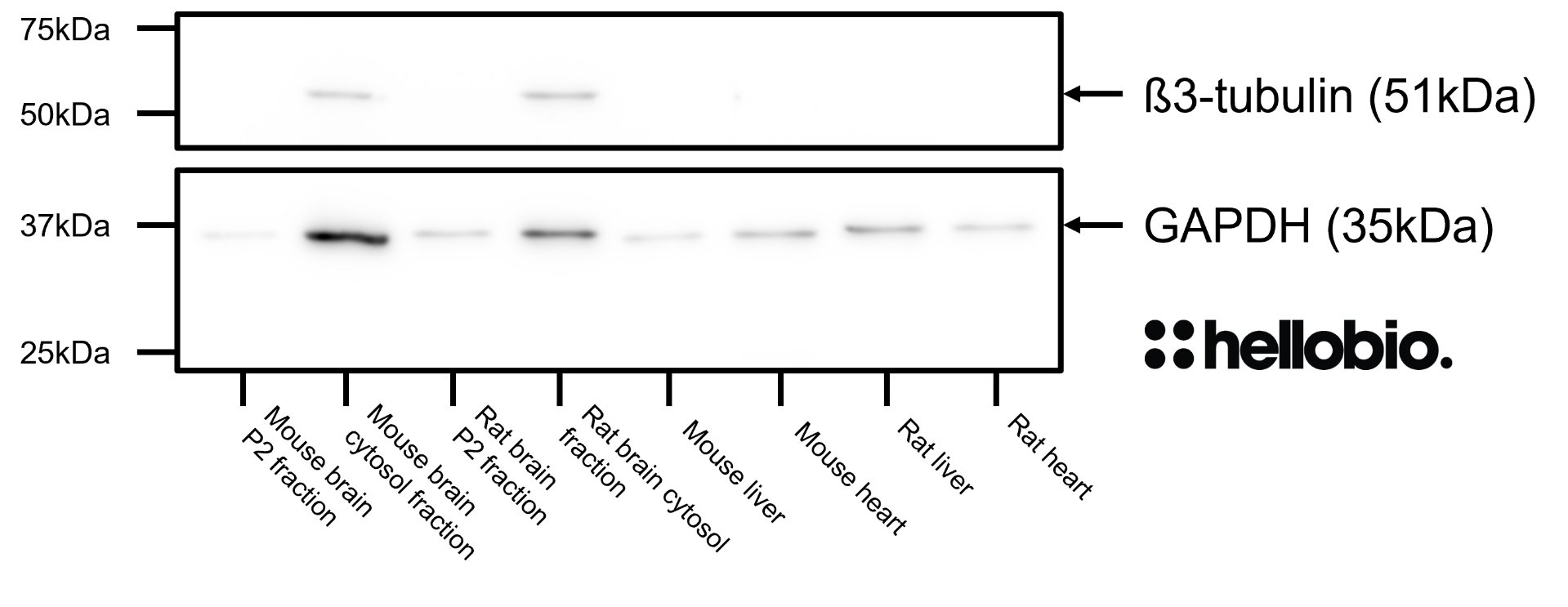 Figure 7. β3-tubulin expression in various tissue lysates and preparations with GAPDH loading control. 