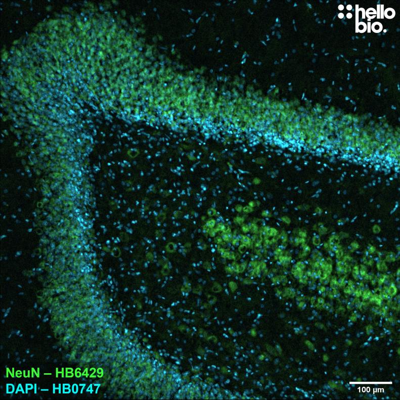 Figure 4. NeuN expression in the rat dentate gyrus visualised using HB6429. Figure 4. NeuN expression in the rat dentate gyrus visualised using HB6429.