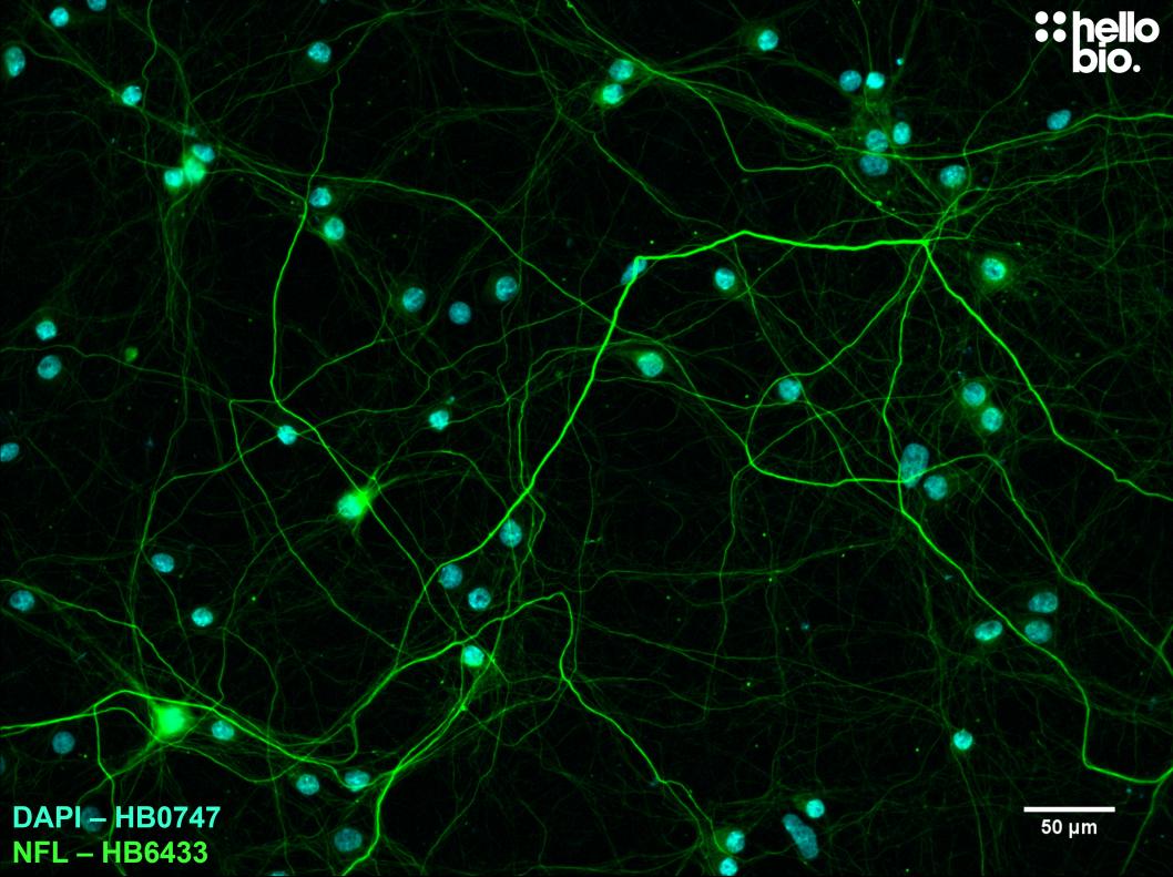 Figure 8. Neurofilament L expression in cultured rat neurones visualised using HB6433. 
