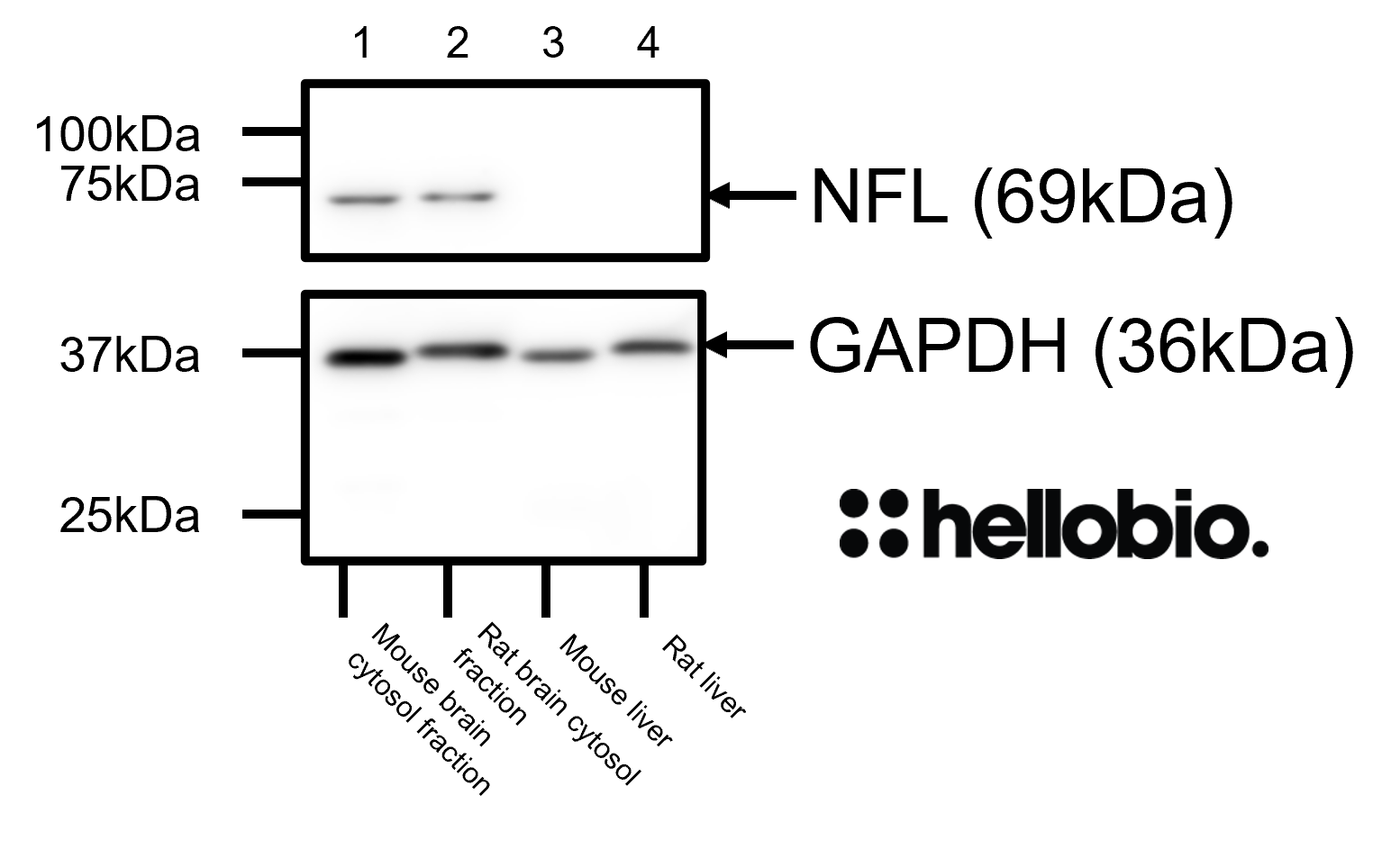 Figure 9. Neurofilament L and GAPDH expression in brain cytosol and liver preparations. 