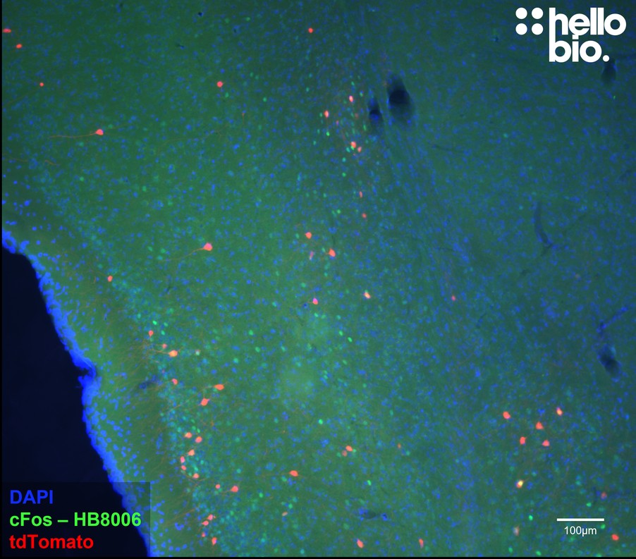 Figure 2. c-Fos expression in the cortex of TRAP2;Ai14 mice.