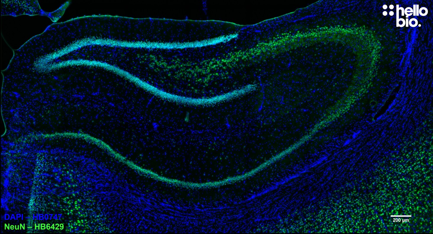 Figure 1. HB6429 staining of NeuN expressing neurons in rat hippocampus. Figure 1. HB6429 staining of NeuN expressing neurons in rat hippocampus.