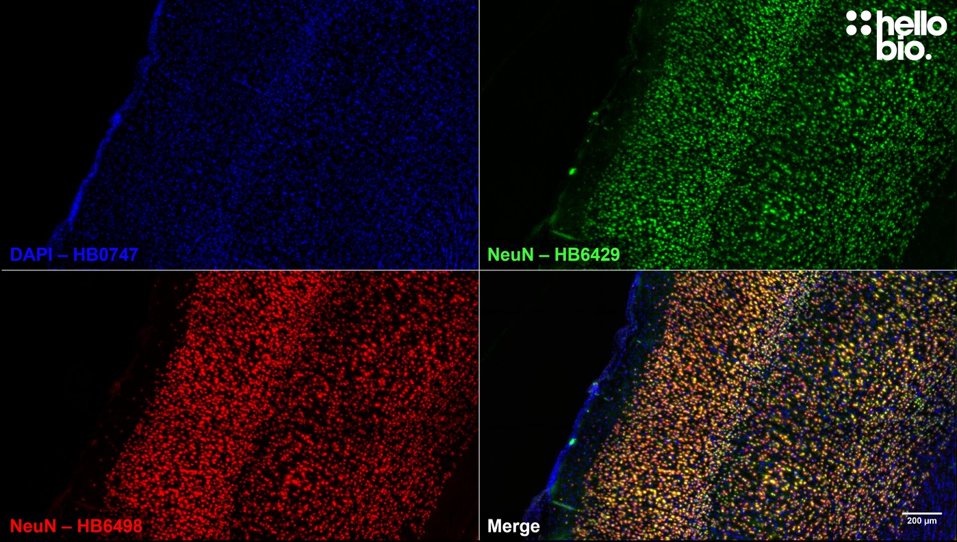 Figure 3. Independent antibody validation of HB6429 in rat cortex. Figure 3. Independent antibody validation of HB6429 in rat cortex.