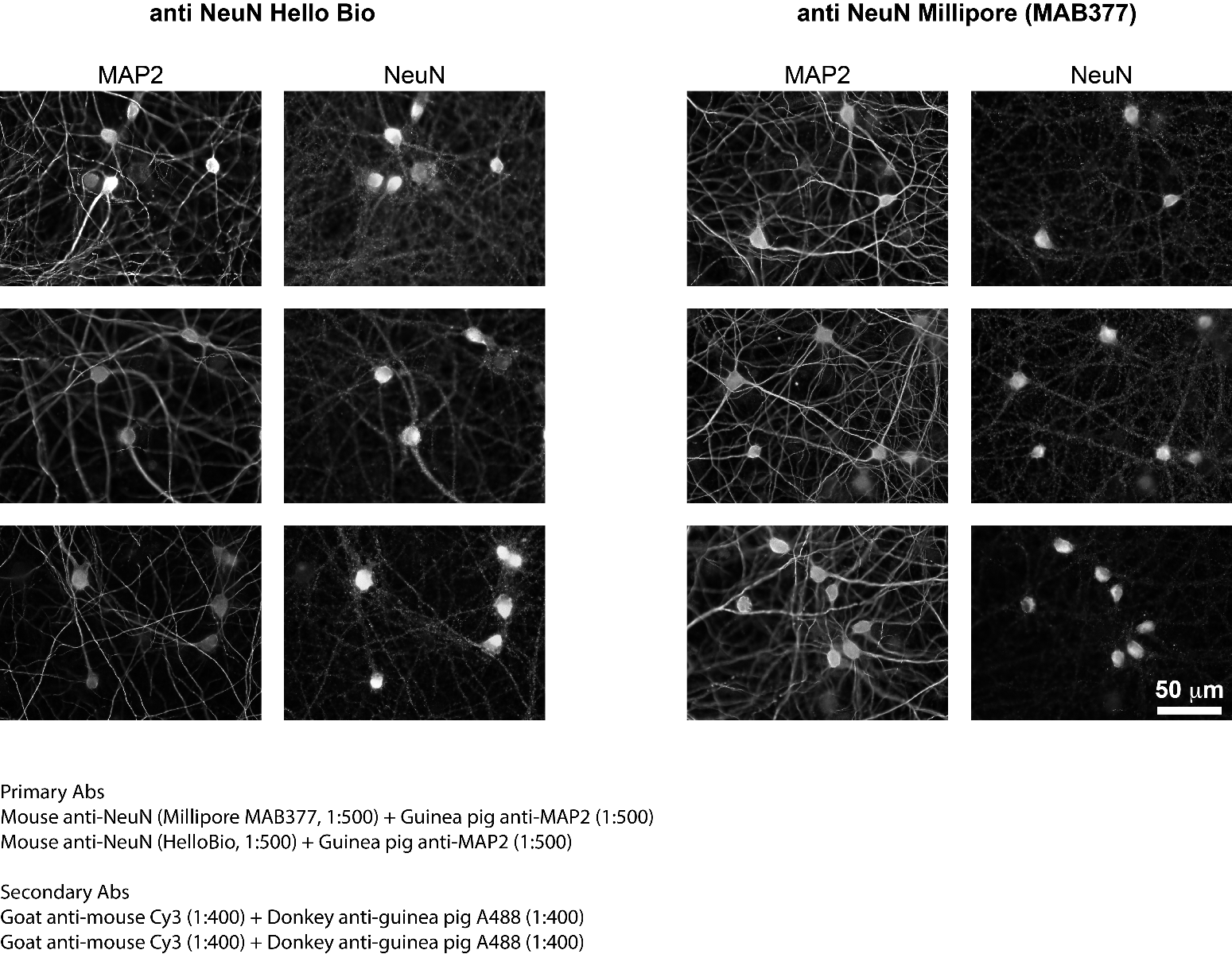 Immunostainings comparing NeuN staining in mouse brain slices Immunostainings comparing NeuN staining in mouse brain slices