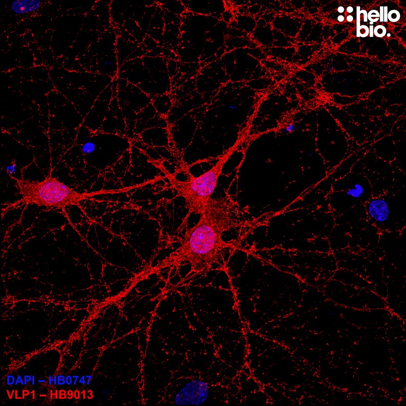 Figure 6. VLP1 expressing cultured rat hippocampal neurons stained by HB9013.