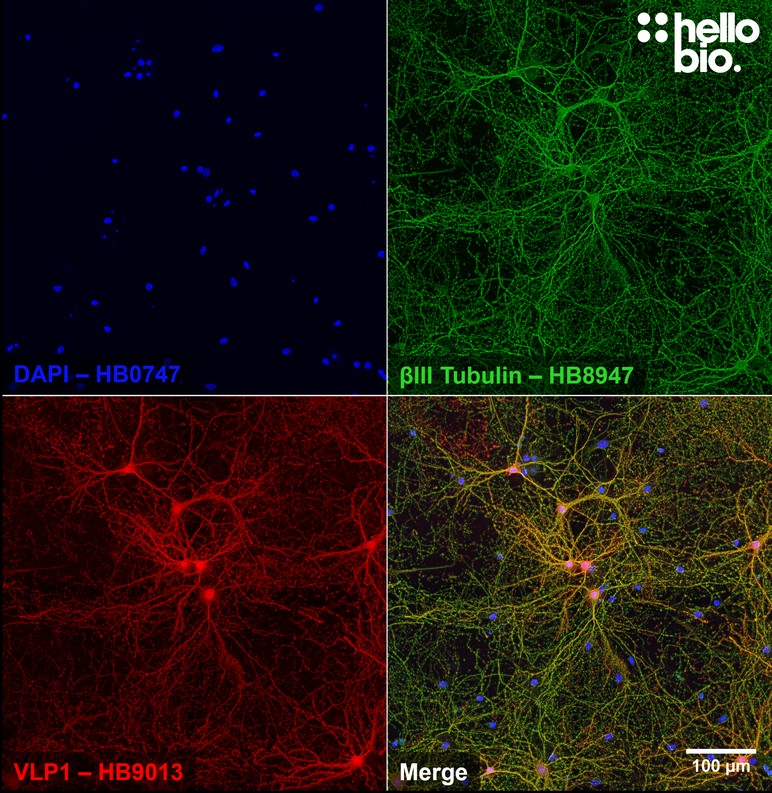 Figure 8. βIII Tubulin and VLP1 staining patterns in cultured rat hippocampal neurons.