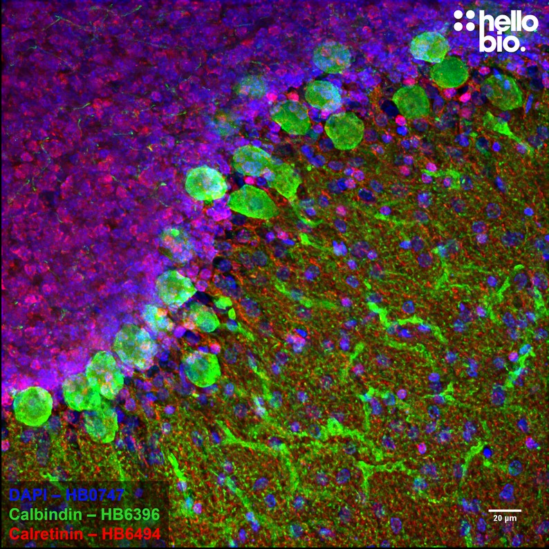 Figure 10. Calretinin and Calbindin expression in rat cerebellum