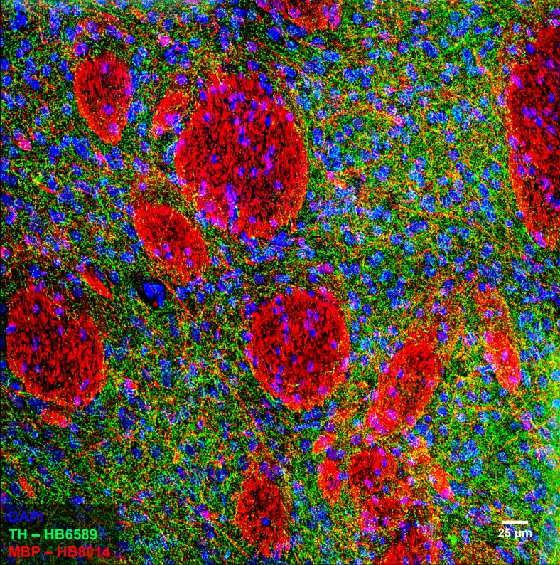 Figure 5. MBP and Tyrosine hydroxylase staining in rat striatum