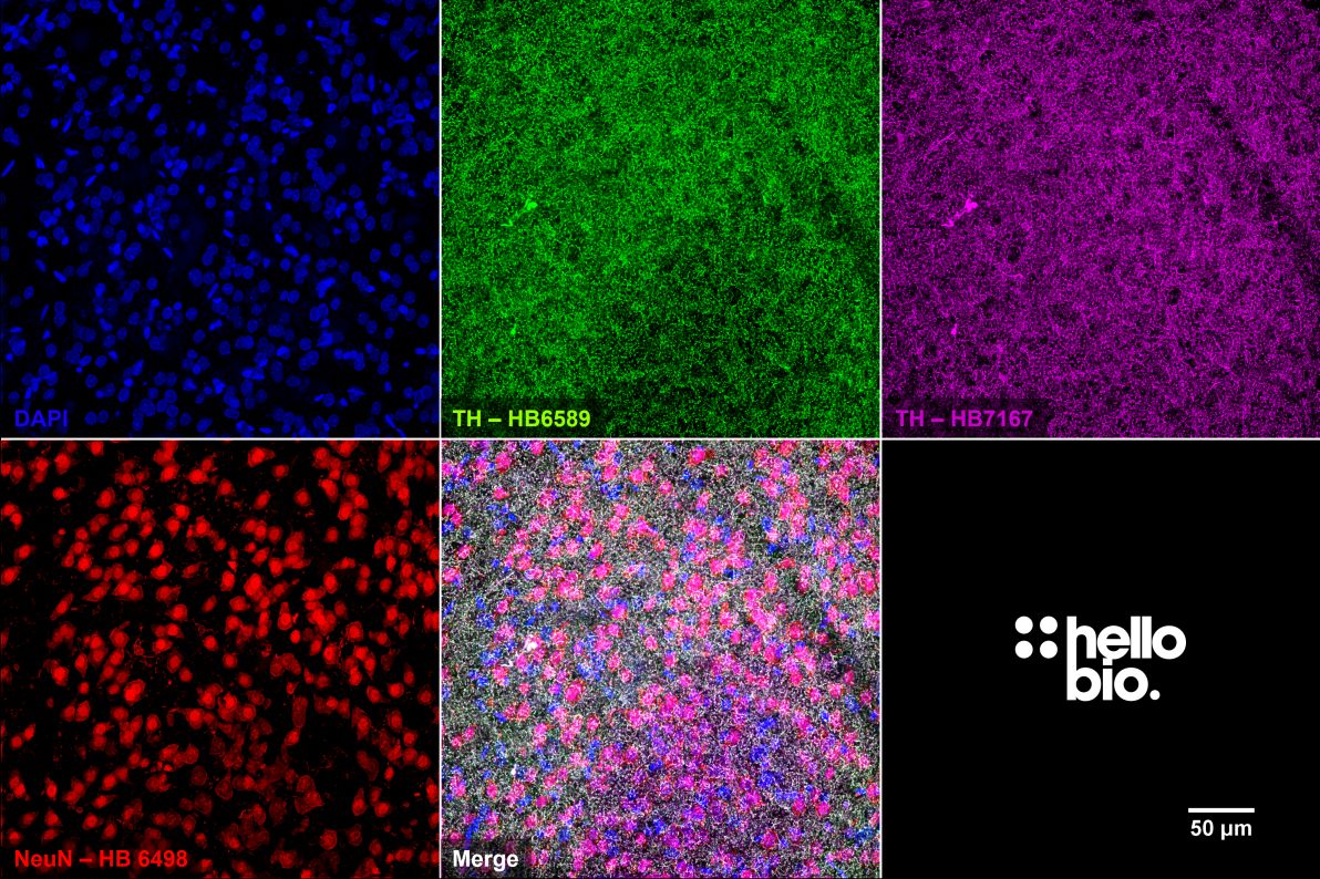 Figure 10. Independent antibody validation of HB7167 and HB6589 in CPu.