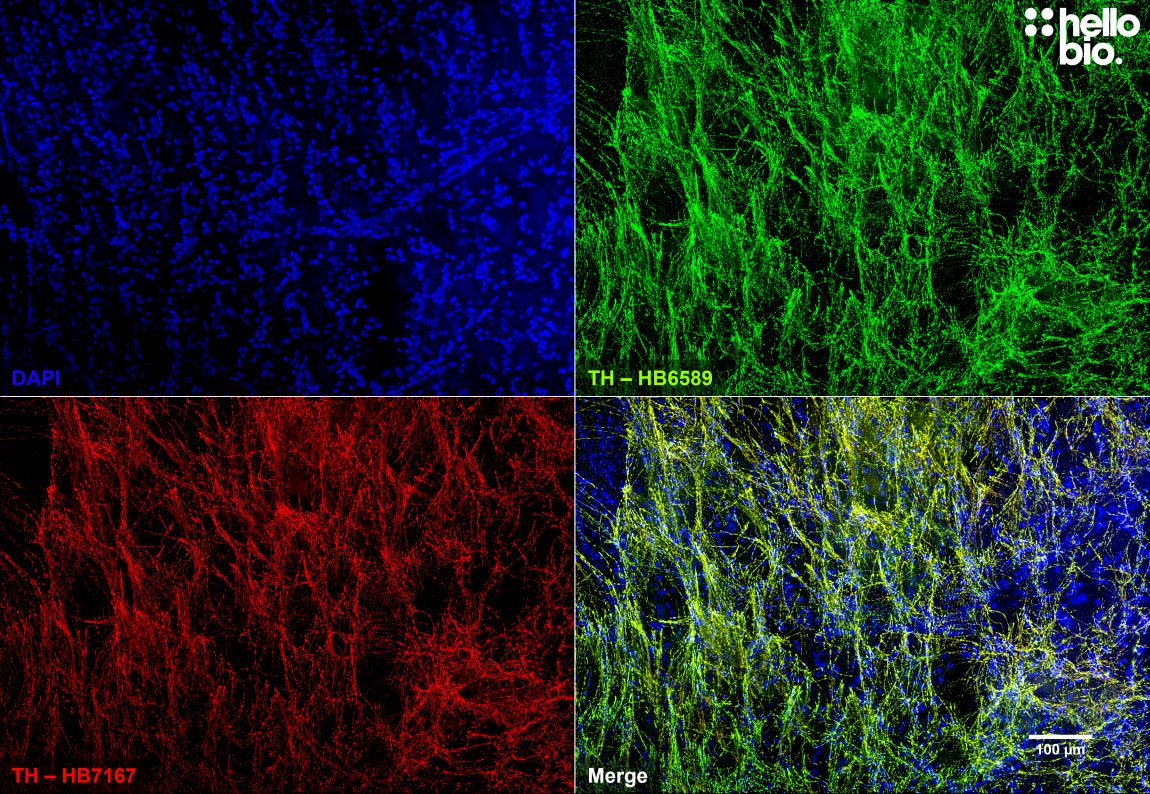 Figure 8. Independent antibody validation of HB7167 and HB6589 in dopaminergic projections.