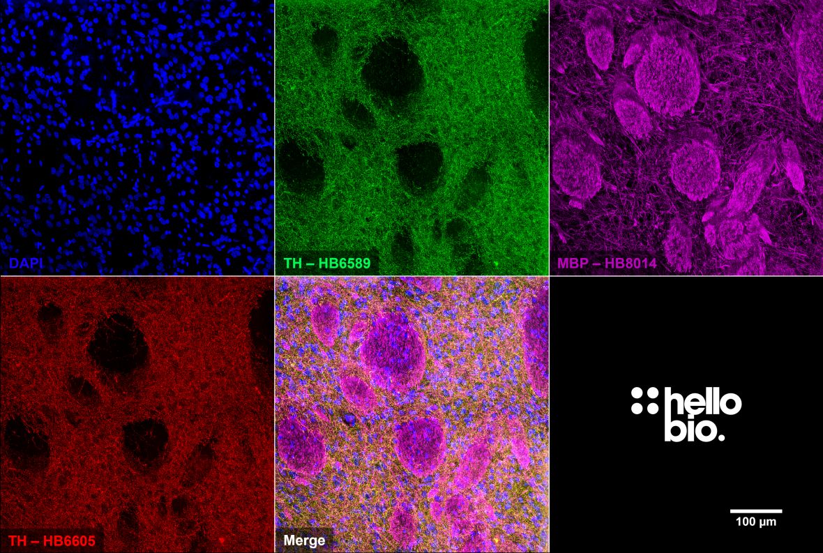 Figure 9. Independent antibody validation of HB6589 in rat caudate putamen.