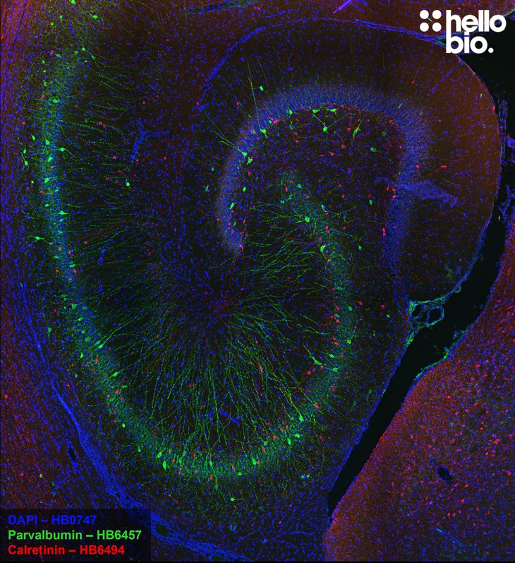 Figure 1. Calretinin and Parvalbumin expressing interneurons in the rat hippocampus