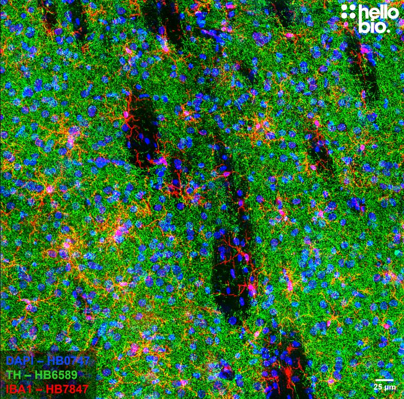 Figure 10. Microglia surrounded by dopaminergic projections in the striatum