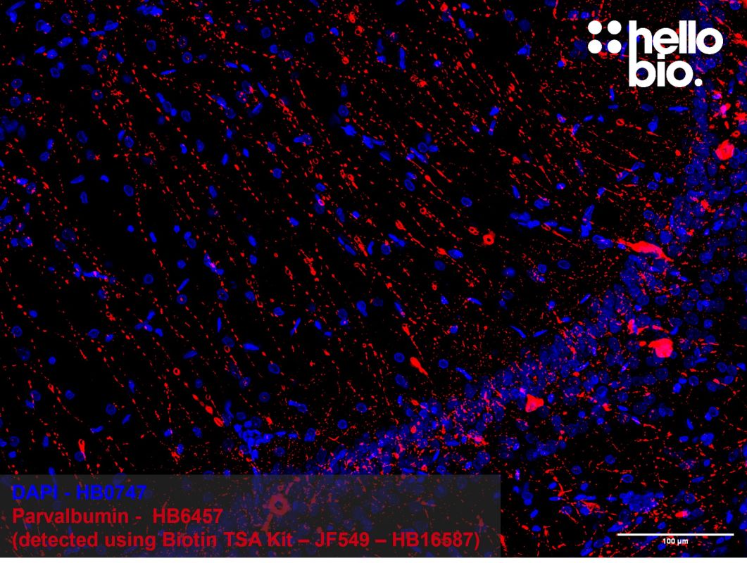 Figure 1: Tyramide signal amplification of parvalbumin positive interneurons in the rat hippocampus. 