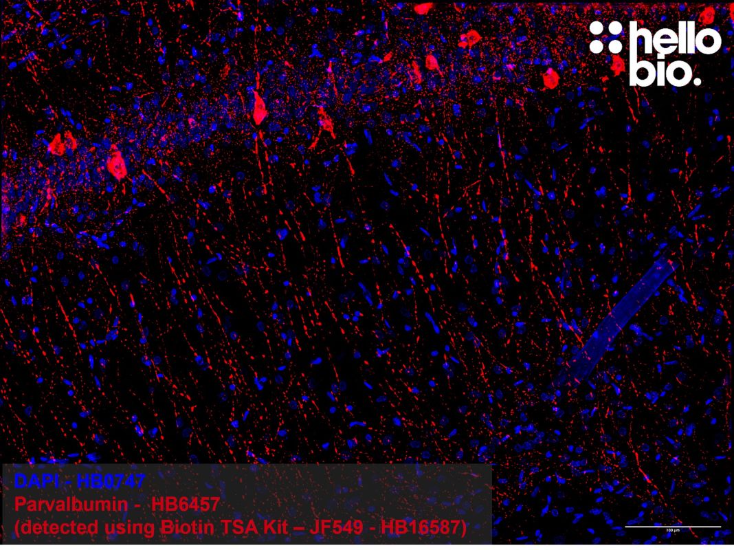 Figure 4: Tyramide signal amplification of parvalbumin positive interneurons in the rat hippocampus. 