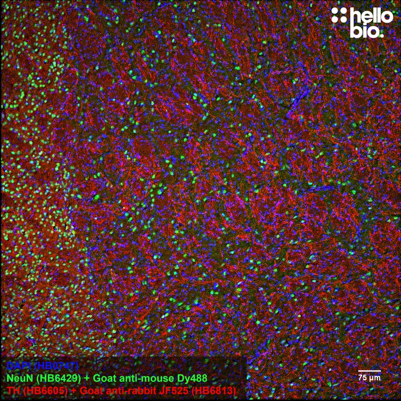 Figure 1. Tyrosine hydroxylase staining in rat striatum using HB6813 Goat Anti-Rabbit IgG H&L (Janelia Fluor® 525) preadsorbed secondary antibody.