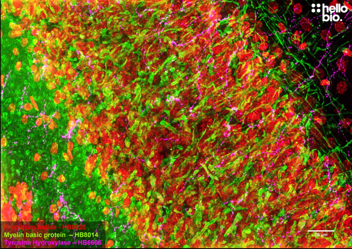Figure 1. MBP and TH staining in rat cerebellum. Mounted using MightyMount<sup>TM</sup> Antifade Fluorescence Mounting Medium with propidium iodide (hardset).