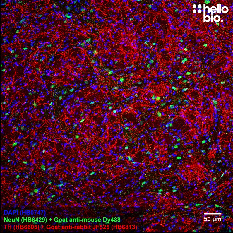Figure 2. Tyrosine hydroxylase staining in rat striatum using HB6813 Goat Anti-Rabbit IgG H&L (Janelia Fluor® 525) preadsorbed secondary antibody.