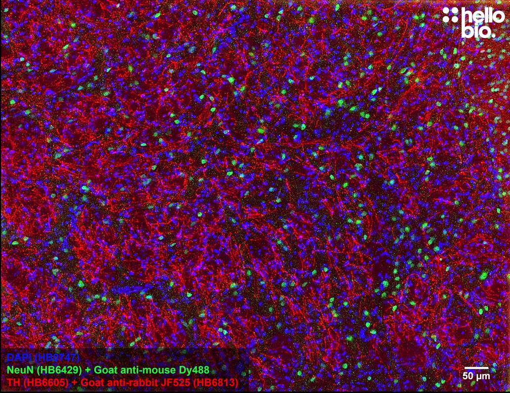 Figure 3. Tyrosine hydroxylase staining in rat striatum using HB6813 Goat Anti-Rabbit IgG H&L (Janelia Fluor® 525) preadsorbed secondary antibody.