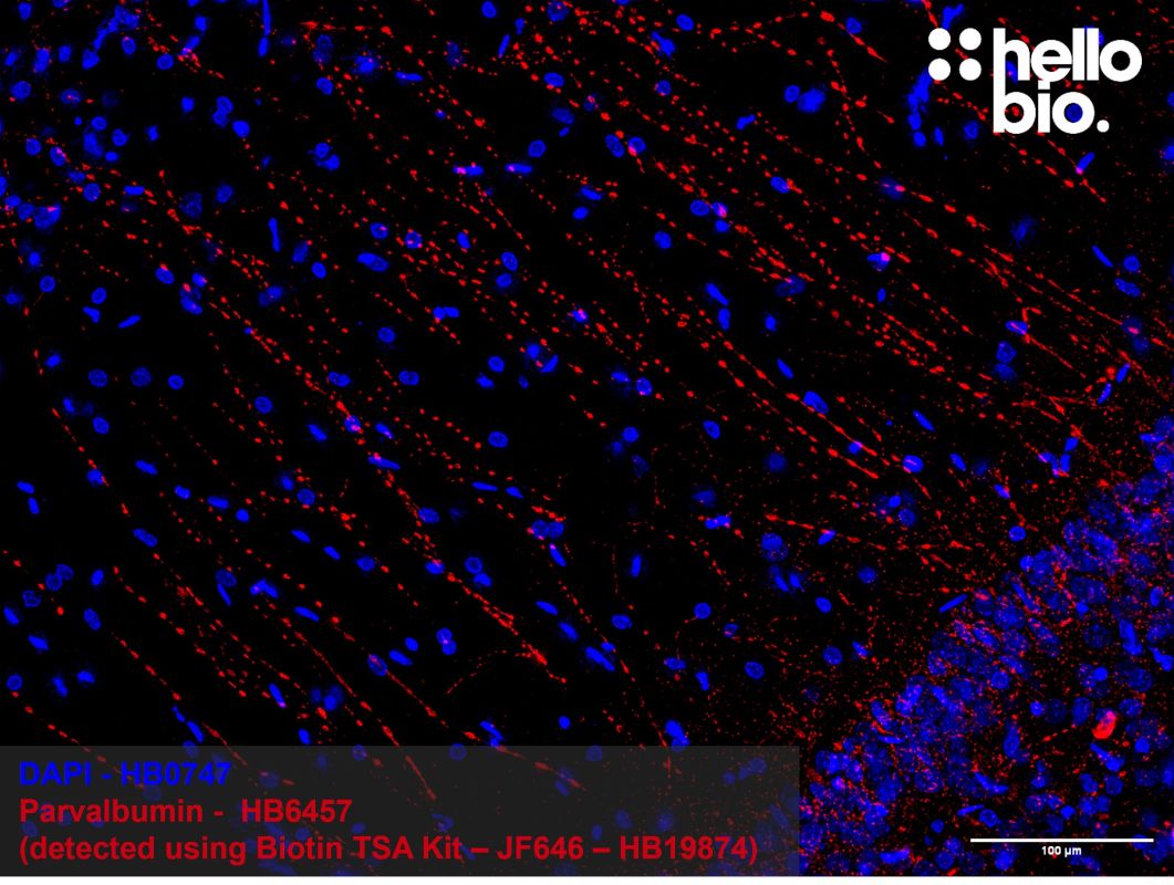 Figure 2: Tyramide signal amplification of parvalbumin positive interneurons in the rat hippocampus. 