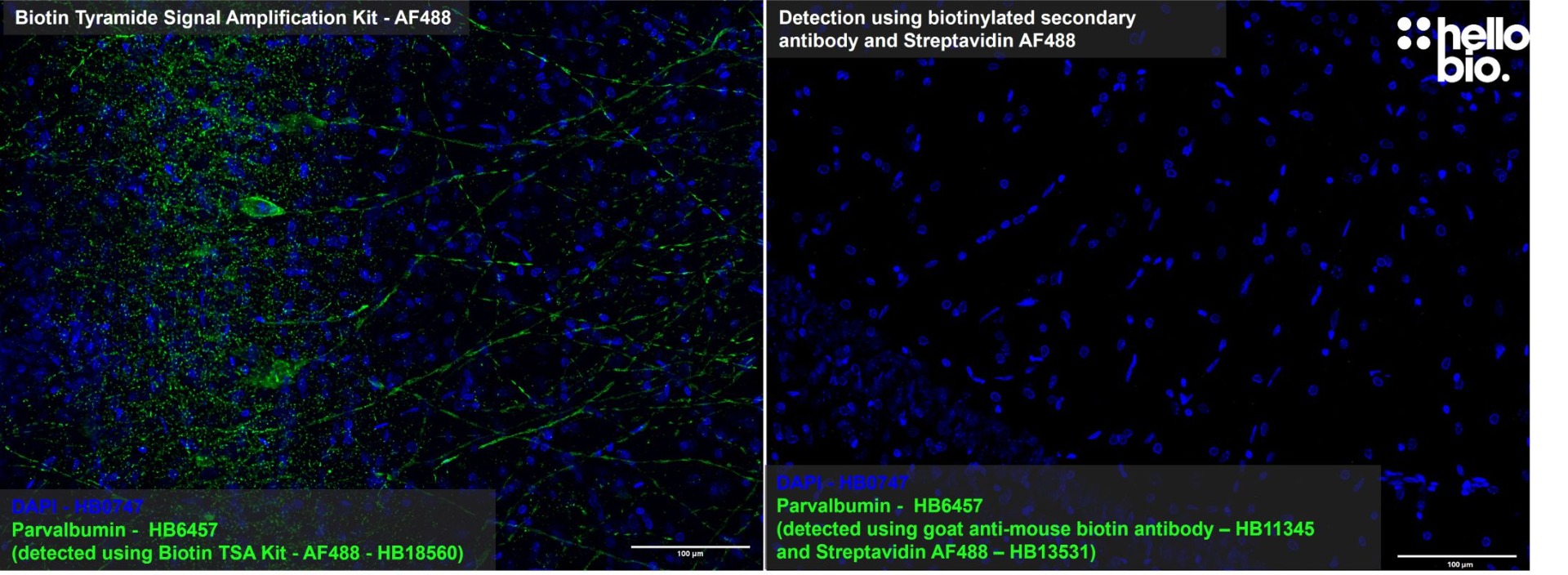 Figure 3: Tyramide Signal Amplification  compared to detection using secondary biotin antibody and streptavidin.
