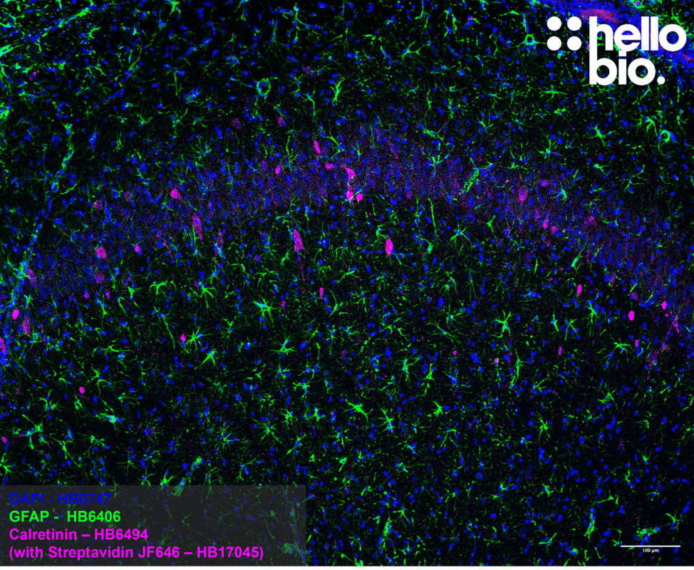 Figure 1. Calretinin positive interneurons and astrocytes in the rat hippocampus. Figure 1. Calretinin positive interneurons and astrocytes in the rat hippocampus.