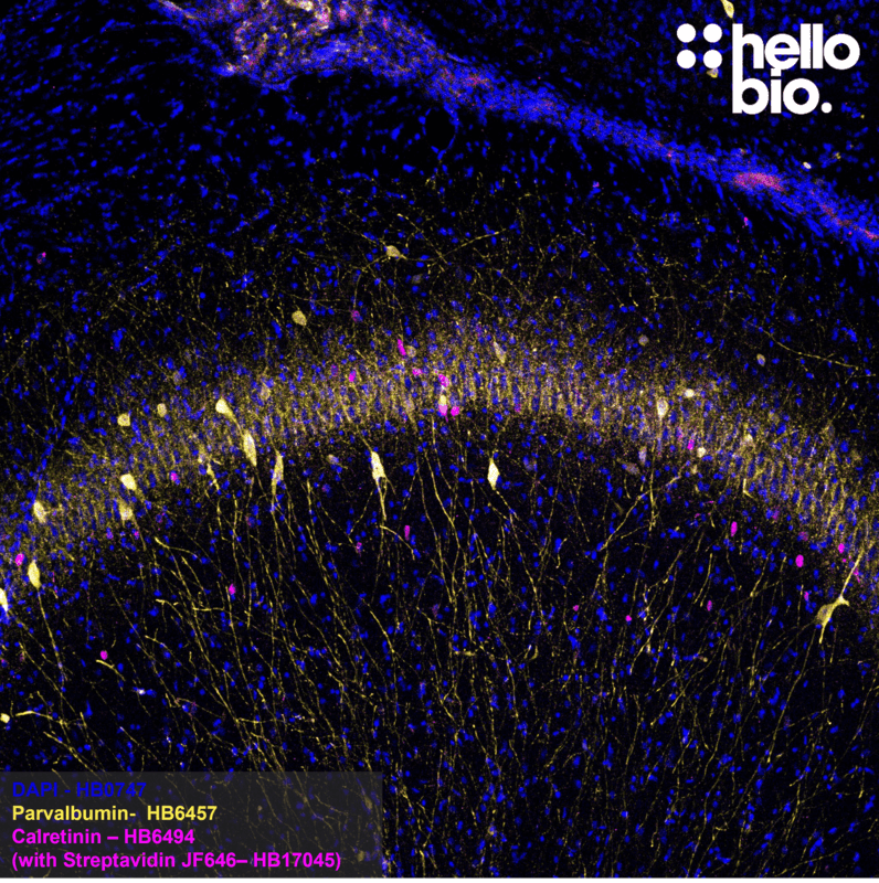 Figure 3. Calretinin and Parvalbumin expression in rat hippocampus. Figure 3. Calretinin and Parvalbumin expression in rat hippocampus.