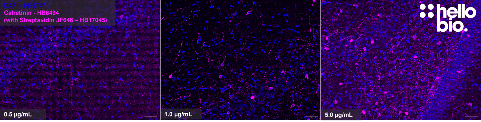 Figure 5. Concentration response of HB17046 staining in rat hippocampus. Figure 5. Concentration response of HB17046 staining in rat hippocampus.