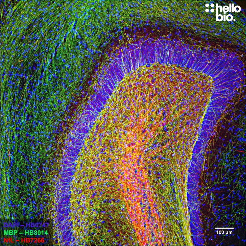 Figure 9. MBP and Neurofilament L staining in rat dentate gyrus. Mounted using MightyMount<sup>TM</sup> Antifade Fluorescence Mounting Medium (aqueous).