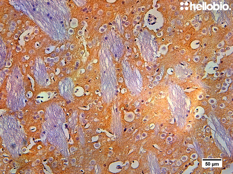 Figure 3. Tyrosine hydroxylase staining in rat striatum visualized using biotin-streptavidin detection.