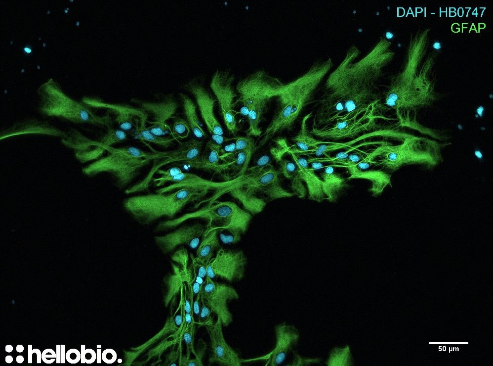 Figure 2. GFAP and DAPI co-staining in hippocampal cell culture Figure 2. GFAP and DAPI co-staining in hippocampal cell culture