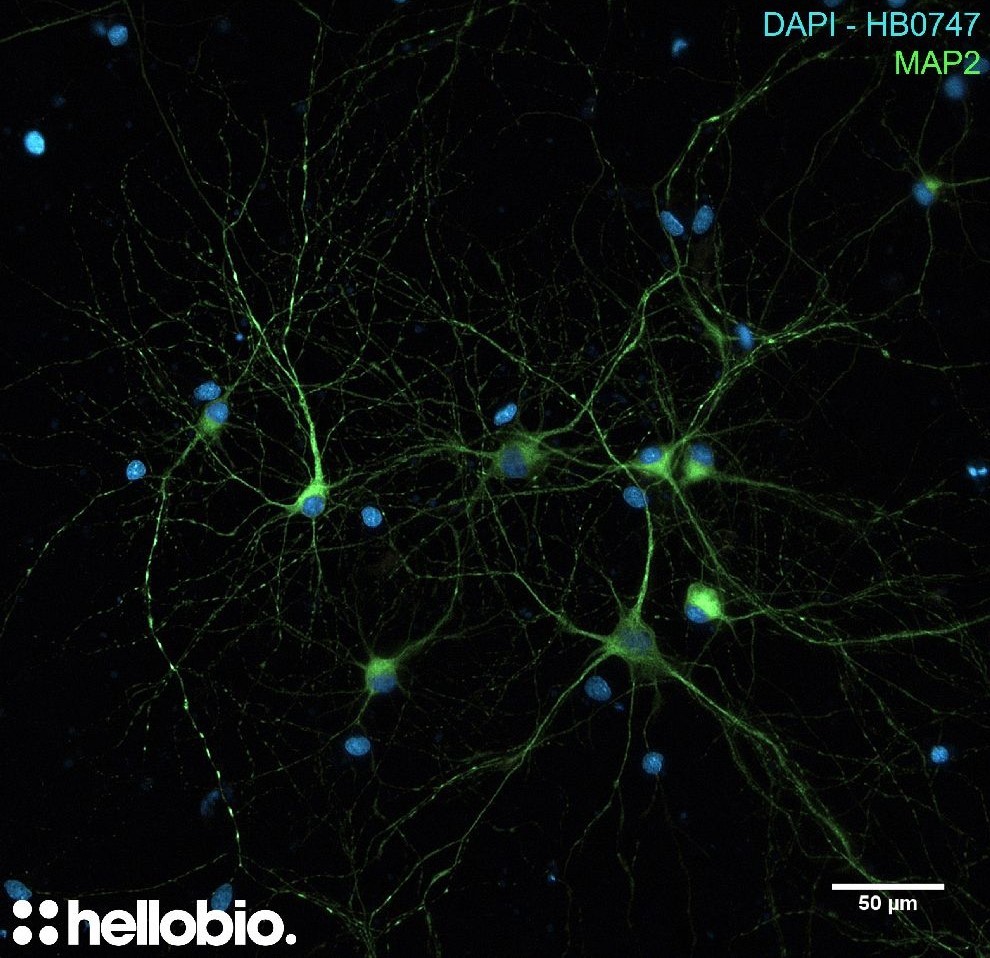 Figure 3. MAP2 and DAPI co-staining in hippocampal cell culture Figure 3. MAP2 and DAPI co-staining in hippocampal cell culture