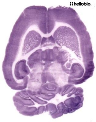 Figure 1. Histoblot for NeuN in rat brain using NBT/BCIP for detection. Figure 1. Histoblot for NeuN in rat brain using NBT/BCIP for detection.