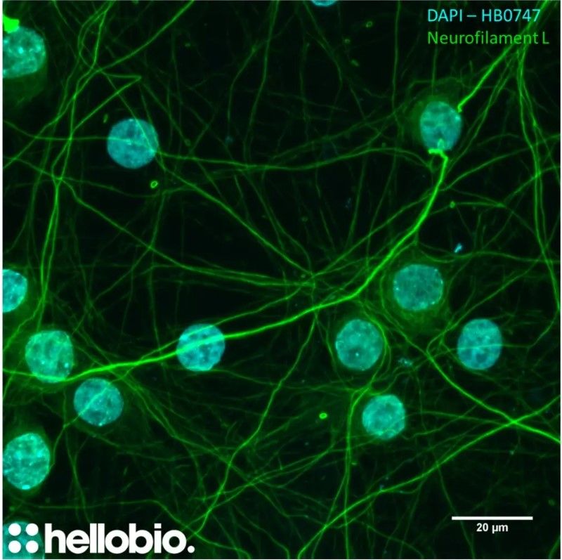 Figure 1. Neurofilament L and DAPI co-staining in hippocampal cell culture Figure 1. Neurofilament L and DAPI co-staining in hippocampal cell culture
