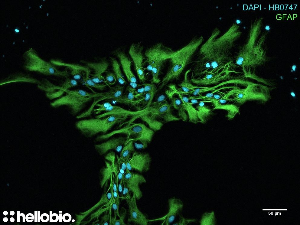 Figure 2. GFAP and DAPI co-staining in hippocampal cell culture Figure 2. GFAP and DAPI co-staining in hippocampal cell culture