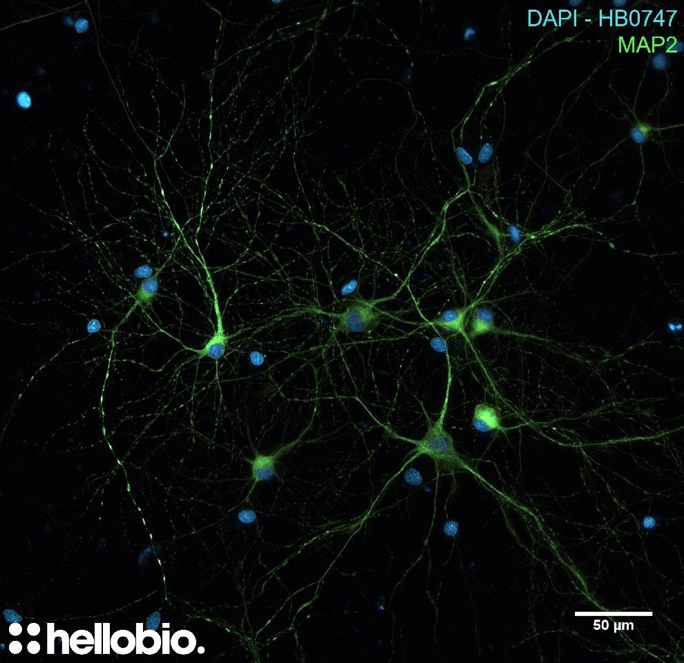Figure 3. MAP2 and DAPI co-staining in hippocampal cell culture Figure 3. MAP2 and DAPI co-staining in hippocampal cell culture