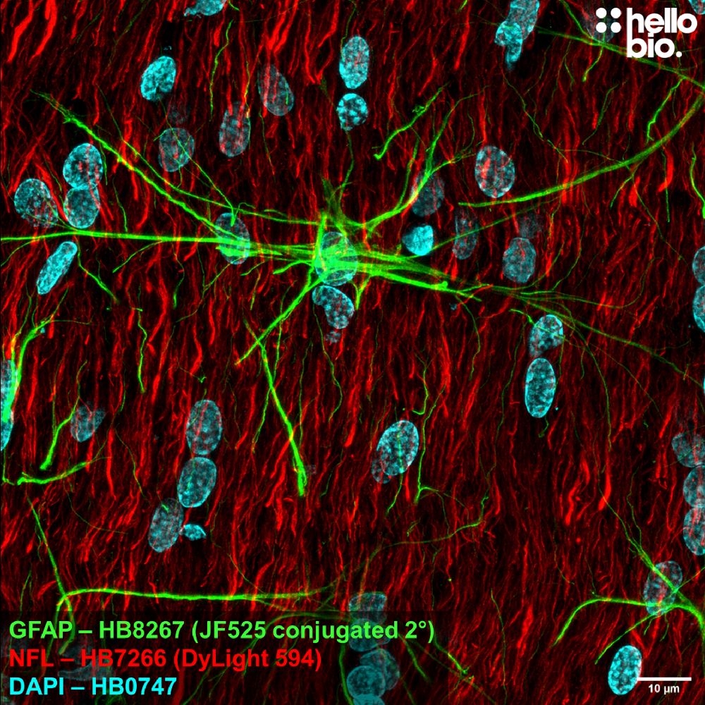 Fig 2. GFAP expression in rat brain visualised using a Janelia Fluor® 525 conjugated secondary antibody. 